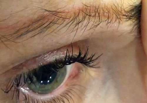 Does microblading cause long term damage?