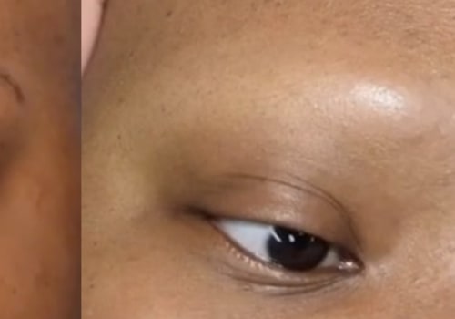Microblading where there is no hair?